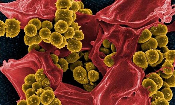 Staphylococcus aureus kui bakteriaalse prostatiidi põhjus